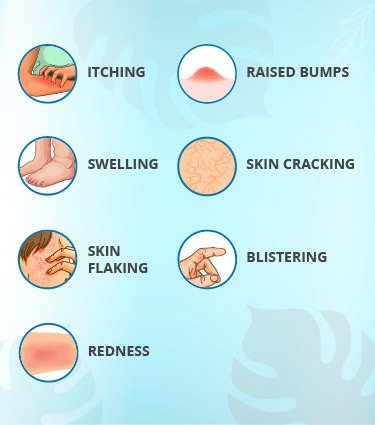 Skin Allergy Treatment